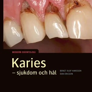 Karies sjukdom och hål :