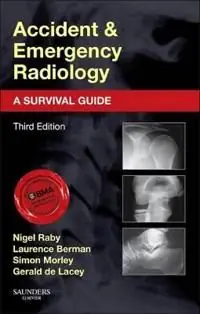 Accident and emergency radiology: a survival guide